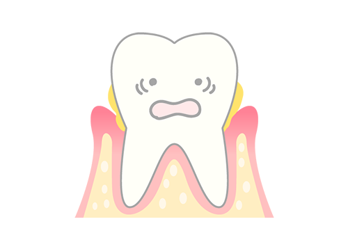 歯周病治療