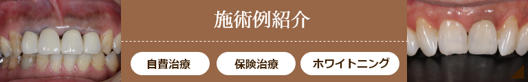 施術例